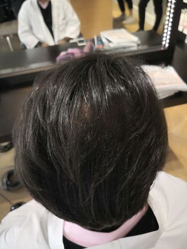 Arrière de la tête avec cheveux noirs après deux mois d'utilisation de la cure PHYTOLOGIST 15
